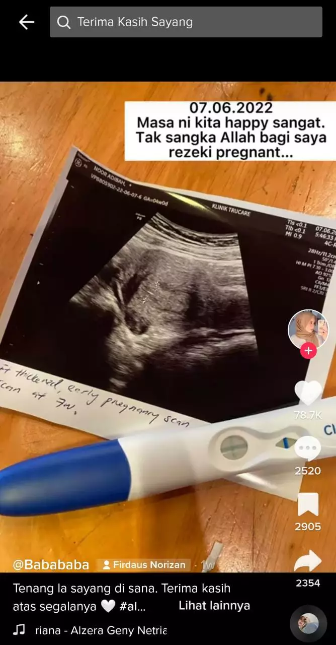 Kisah pilu wanita ditinggal suami meninggal saat hamil Tiktok Kisah pilu wanita ditinggal suami meninggal saat hamil Tiktok