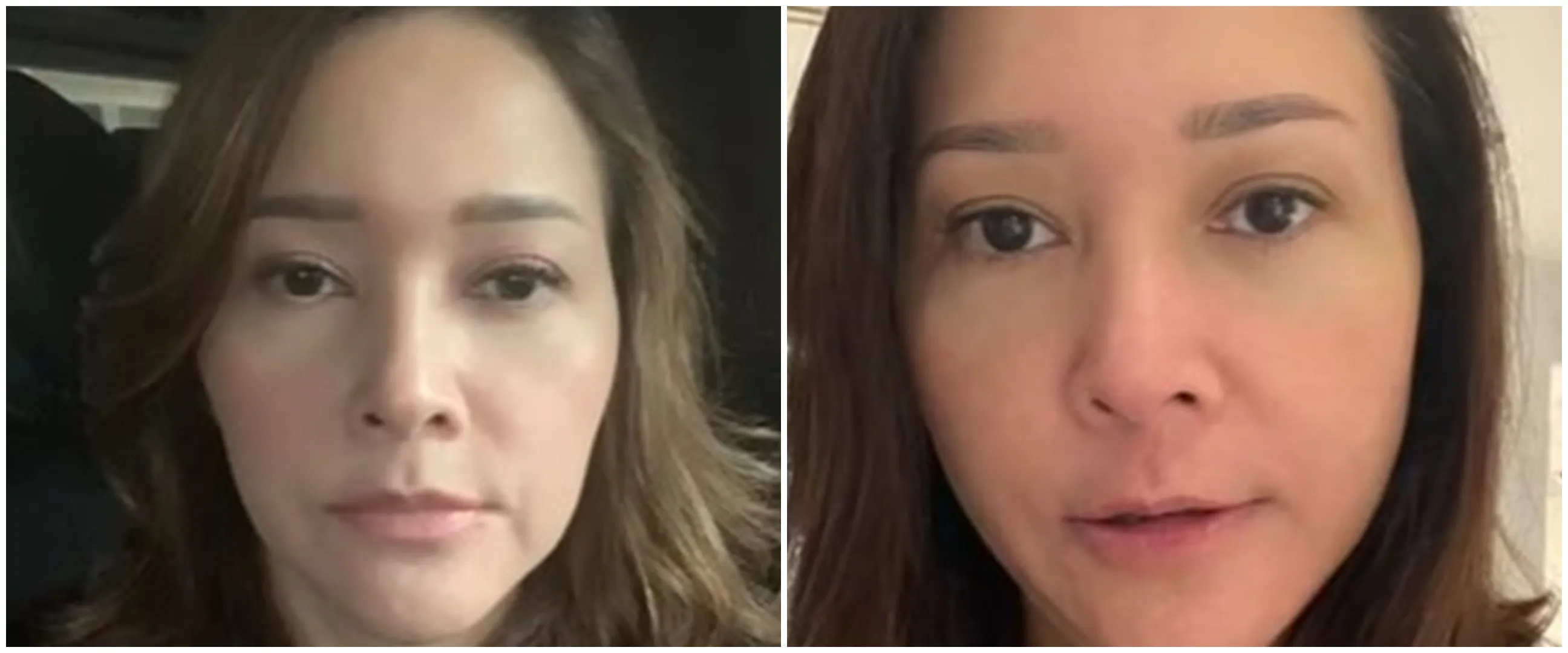 Potret 9 artis sebelum dan sesudah botoks, Maia Estianty manglingi