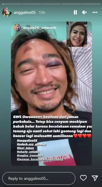 Charly Van Houten alami kecelakaan © Instagram