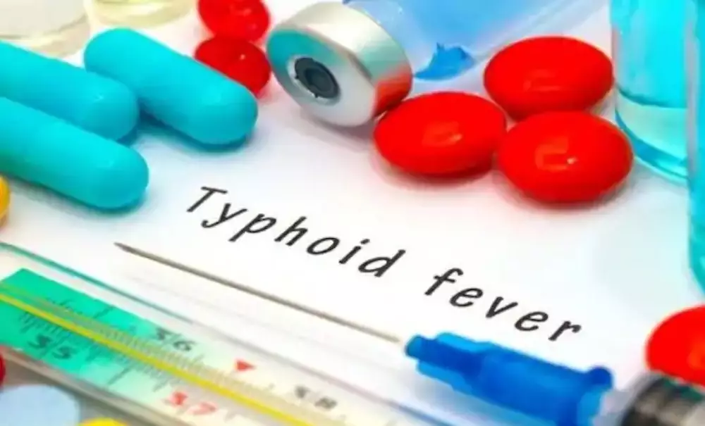 Penyebab Tipes © 2022 brilio.net