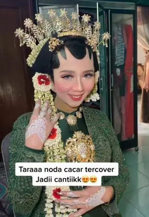 Transformasi makeup pengantin dengan bekas cacar ini bikin takjub TikTok Transformasi makeup pengantin dengan bekas cacar ini bikin takjub TikTok