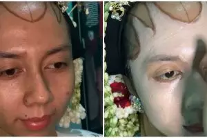 Transformasi makeup pengantin dengan bekas cacar ini bikin takjub