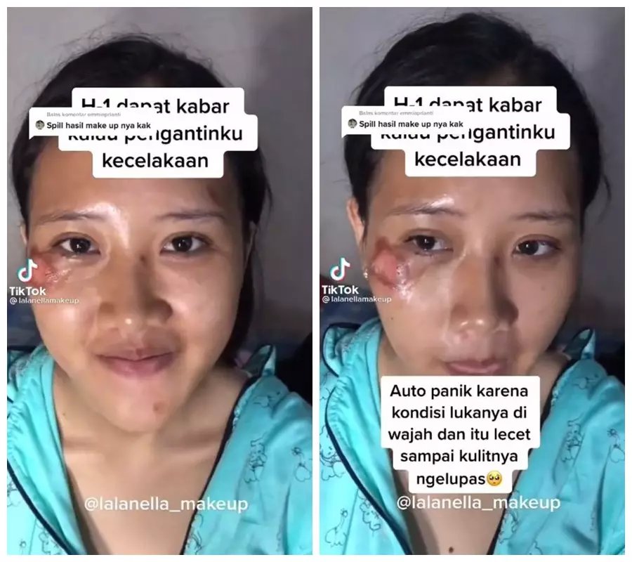 makeup MUA pengantin kecelakaan © TikTok/@lalanellamakeup makeup MUA pengantin kecelakaan © TikTok/@lalanellamakeup