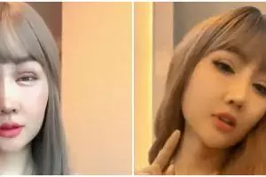 10 Potret terbaru Lucinta Luna usai operasi plastik, wajah makin tirus