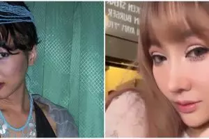 9 Potret beda Lucinta Luna sebelum dan usai operasi plastik terbaru