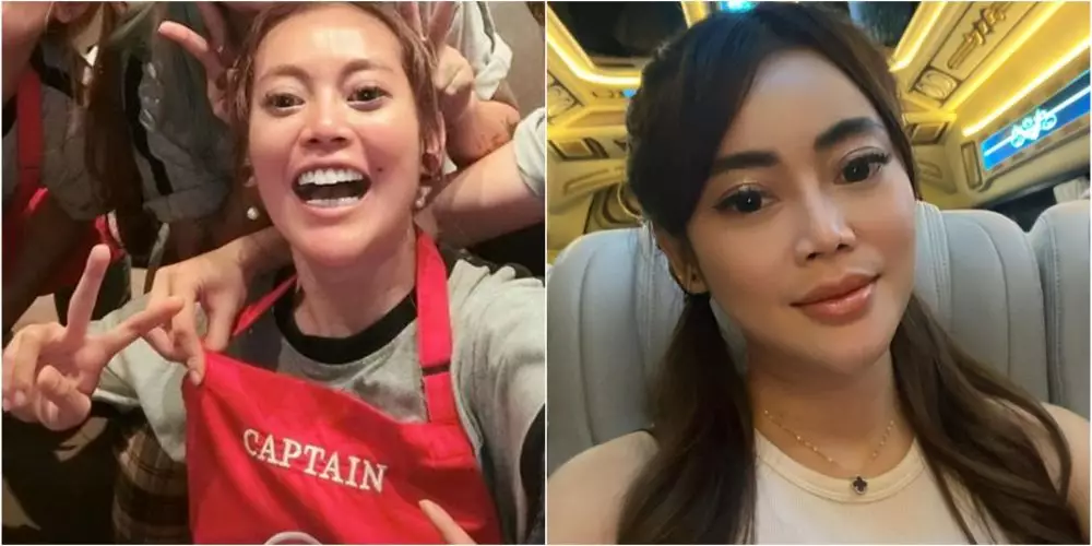 Potret dulu dan kini Daniar Masterchef usai operasi hidung Berbagai sumber