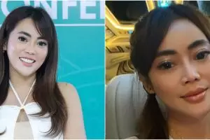 7 Potret dulu dan kini Daniar Masterchef usai operasi hidung