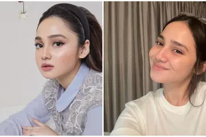 6 Rahasia wajah cerah tanpa jerawat Syifa Hadju, gunakan infus diamond