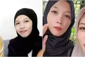 Kisah saudara kembar 24 tahun pisah sebab mitos, bertemu berkat medsos