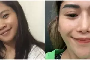 Tiga kali operasi plastik, ini 11 transformasi vlogger Farida Nurhan