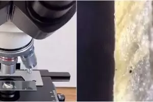 Bikin syok, ini 'penghuni' kuku saat dilihat pakai mikroskop 