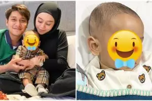 Anak Lesty Kejora akan jalani operasi hernia, Rizky Billar minta doa