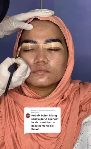 Transformasi makeup barbie look wanita berjerawat TikTok Transformasi makeup barbie look wanita berjerawat TikTok