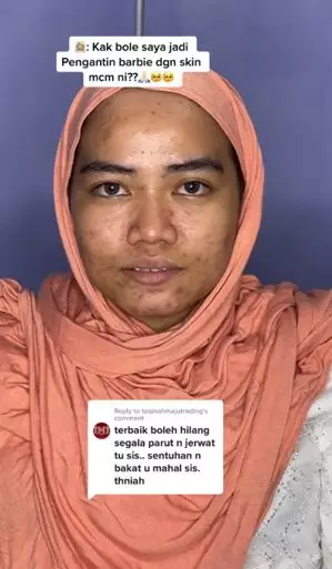 Transformasi makeup barbie look wanita berjerawat TikTok Transformasi makeup barbie look wanita berjerawat TikTok