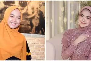 9 Potret beda gaya dulu dan kini Ria Ricis, dagu lancipnya tuai atensi