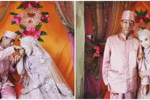 5 Momen Surya Manurung pengidap sindrom langka dan istri usai nikah