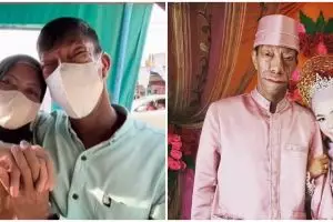 9 Potret cantik istri Surya Manurung pria pengidap sindrom langka