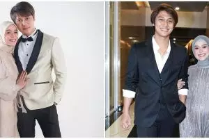 Mata lebam Lesty Kejora jadi viral, ngaku kejatuhan HP Rizky Billar