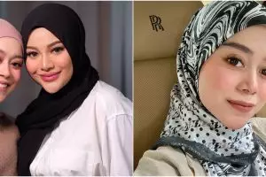 Aurel Hermansyah rela jenguk Lesty jam 12 malam usai ramai kasus KDRT