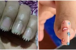13 Bentuk gagal nail art ini hasilnya bikin senyum kecut