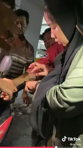 Momen jari wanita nyangkut di stang motor Tiktok Momen jari wanita nyangkut di stang motor Tiktok