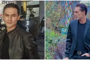 Badan kurus dinyinyiri, Indra Bruggman ungkap penyakit hipertiroid