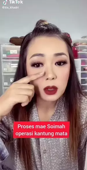 Soimah usai operasi kantung mata © 2022 TikTok Soimah usai operasi kantung mata © 2022 TikTok