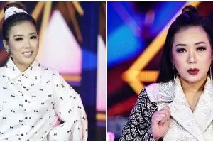 Potret Soimah usai operasi kantung mata, dipuji makin memesona