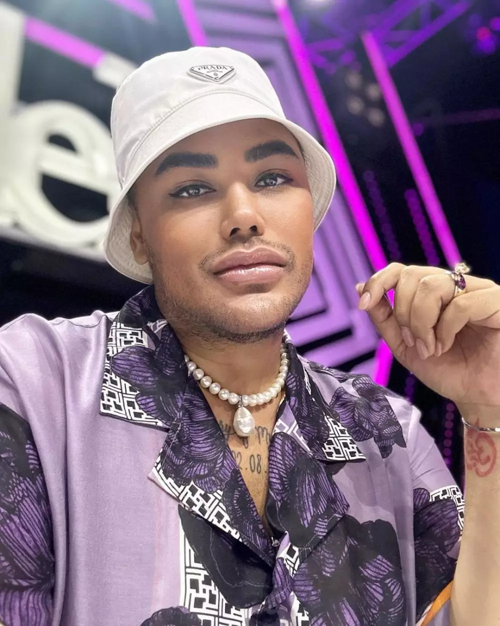 Ivan Gunawan tuai hujatan warganet usai tampil dengan bibir tebal © berbagai sumber