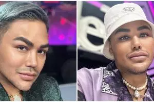 Ivan Gunawan tampil dengan bibir kian tebal, tuai protes warganet