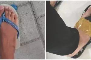 13 Cara nyeleneh orang benerin sandal jepit, ada-ada aja idenya