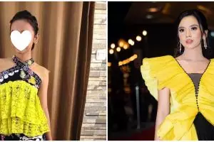 Dulu pernah pakai behel, intip 9 transformasi Lyodra Ginting