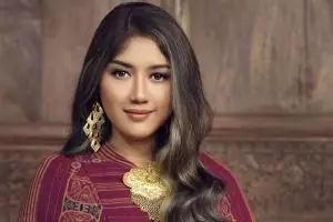 11 Potret lawas Erina Gudono, tampil dengan gigi berbehel