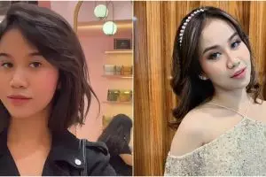 Kondisi Mayang pascaoperasi hidung disorot, disebut mirip Evi Masamba