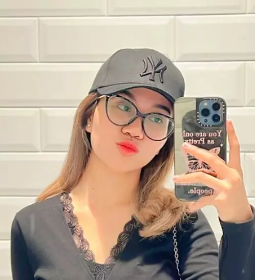 Mayang ungkap alasan operasi hidung © Instagram Mayang ungkap alasan operasi hidung © Instagram