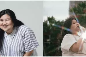 Shena Malsiana finalis X Factor idap penyakit lupus, begini kondisinya