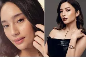 Bukti cantik tak harus mulus, 10 seleb ini tunjukkan foto selfie wajah penuh jerawat