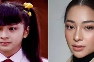 Sempat ditolak jadi artis karena giginya jelek, intip 11 perjalanan karier Nikita Willy