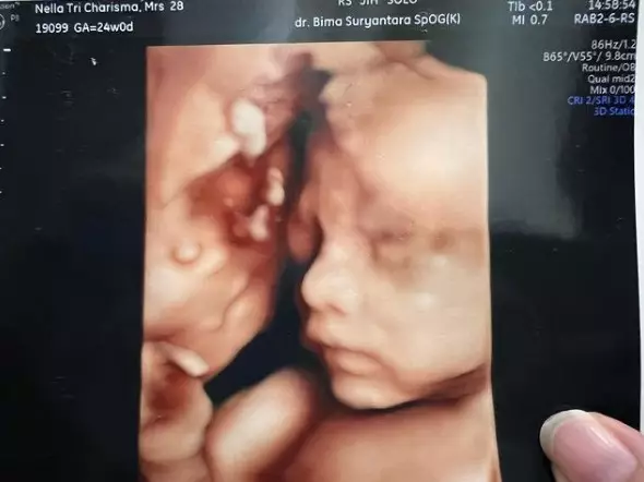 Nella Kharisma hasil usg anak kedua © Instagram Nella Kharisma hasil usg anak kedua © Instagram