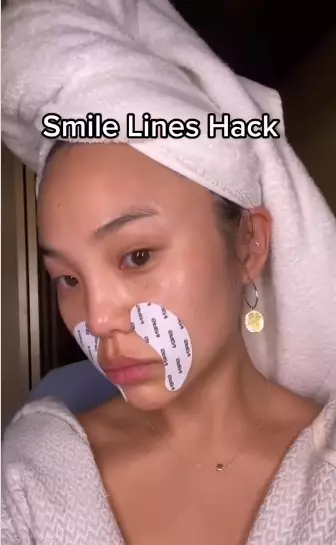 Trik hilangkan smile lines Berbagai sumber