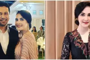 Tak malu sederhana meski jadi istri pejabat, 9 momen Arumi Bachsin tak gengsi jajan di pinggir jalan