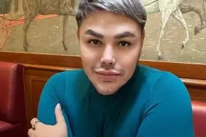 Ivan Gunawan jalani operasi hidung di Turki, ini 7 beda penampilannya yang bikin pangling