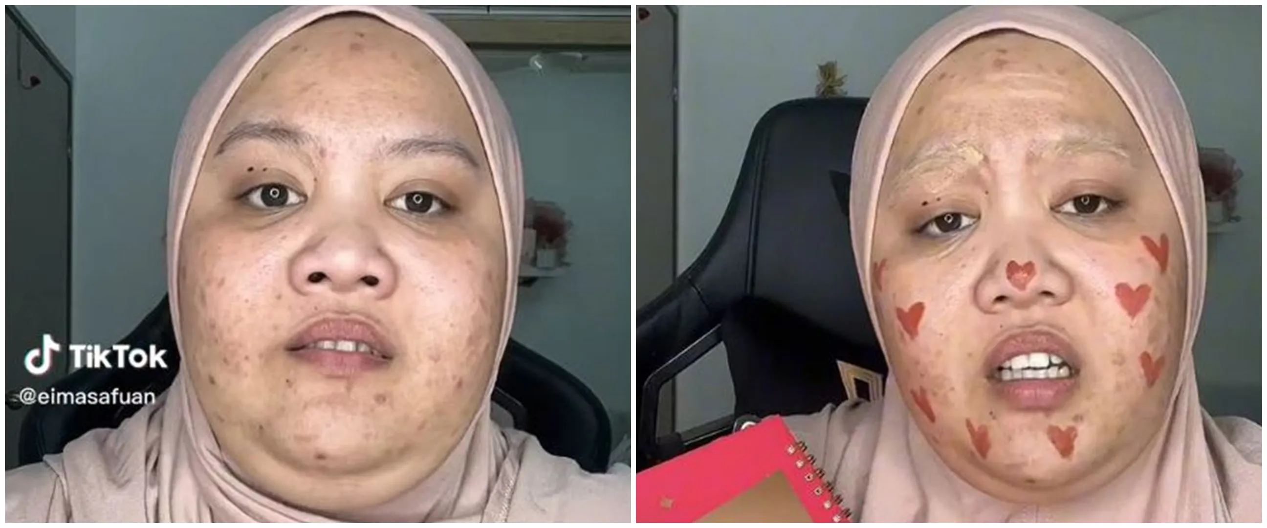 Transformasi makeup wanita berjerawat jadi tampak mulus & tirus ini bikin takjub, dikira beda orang