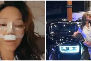 11 Potret terbaru Bunda Corla usai operasi plastik, disebut kian awet muda