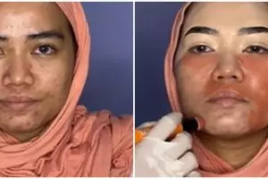 Wanita berjerawat dirias MUA jadi pengantin ala Malaysia ini hasilnya bak Barbie, wajah jadi mulus