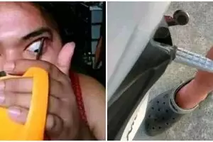 Tertangkap kamera, 11 momen apes orang ini bikin yang lihat ngilu lihatnya