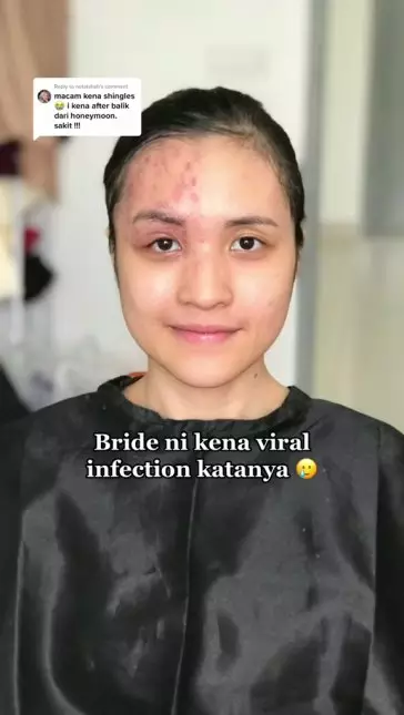 mua rias wajah terinfeksi © TikTok