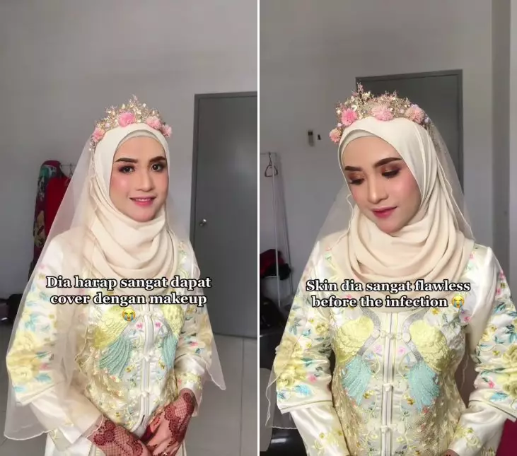 mua rias wajah terinfeksi © TikTok
