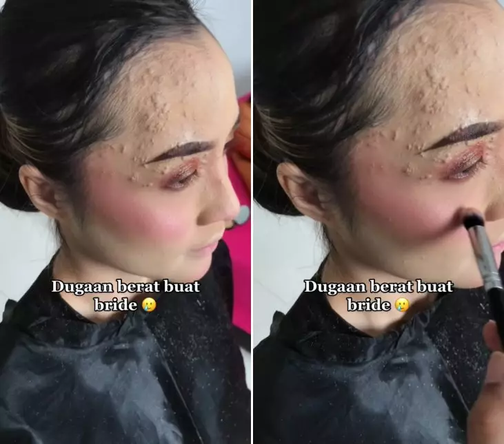 mua rias wajah terinfeksi © TikTok