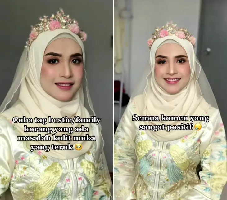 mua rias wajah terinfeksi © TikTok